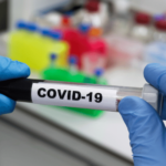 Vial with COVID-19 sample