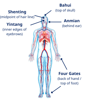 Acupuncture Points for Anxiety and Insomnia